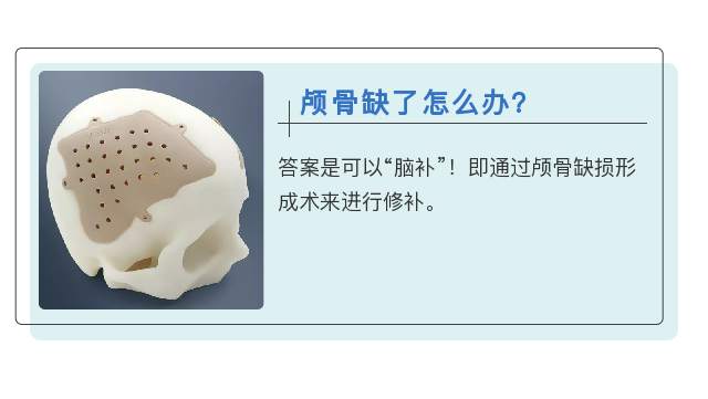 23.png