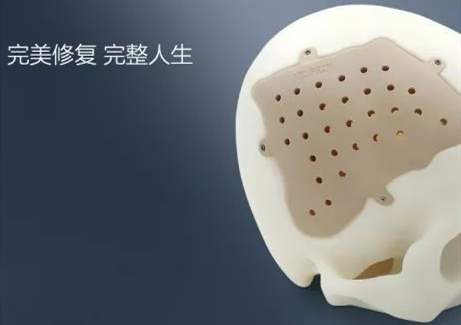 精準定制，完美修復——從“頭”開始